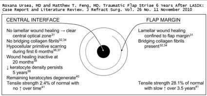 incomplete healing of the LASIK flap