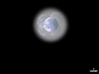 Moon post lasik
